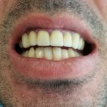 tandartreizen,dental holiday, dental holidays, tandarts buitenland,tandarts Griekenland