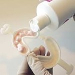 Fluoride trays are used exclusively by the dentist in his office