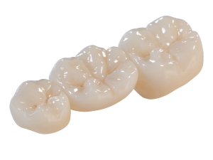 cost of zirconia crown, cost of zirconia crowns, dental crown zirconia, dental zirconia crowns, full contour zirconia crown, how much do zirconia crowns cost, porcelain or zirconia crowns, tooth crown zirconia, types of dental crowns zirconia, what is a zirconia crown, zirconia bridge, zirconia ceramic crown, zirconia crown cost, zirconia crown price, zirconia crowns advantages, zirconia crowns reviews, zirconia dental, zirconia dental bridges, zirconia dental crown, zirconia dental implants, zirconia or porcelain crown, zirconia teeth cost, zirconia teeth crowns, zirconium crown, zirconium crown reviews, zirconium crown strength, zirconium crowns cost, zirconium dental crowns