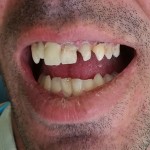 tandartreizen,dental holiday, dental holidays, tandarts buitenland